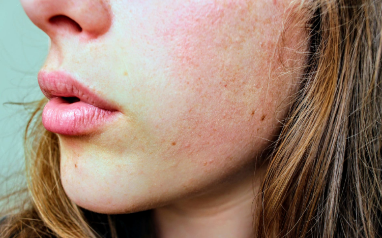How to Find the Right Skincare for You